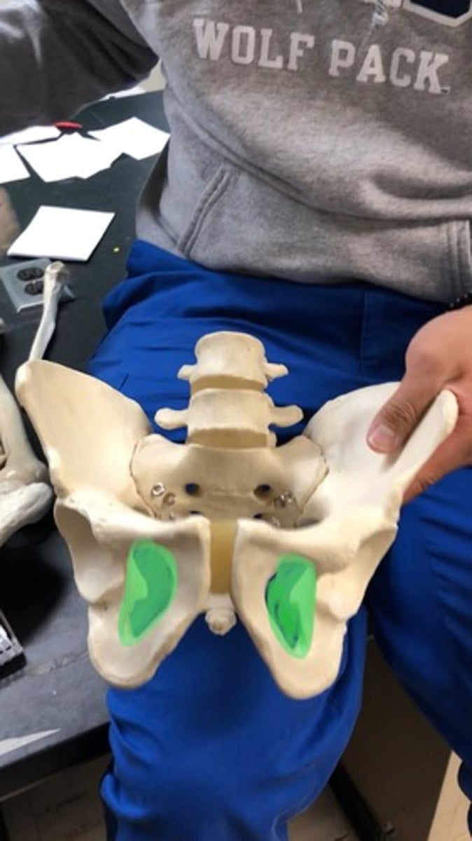 <p>holes on the bottom (2) - in coccyeal bones</p>