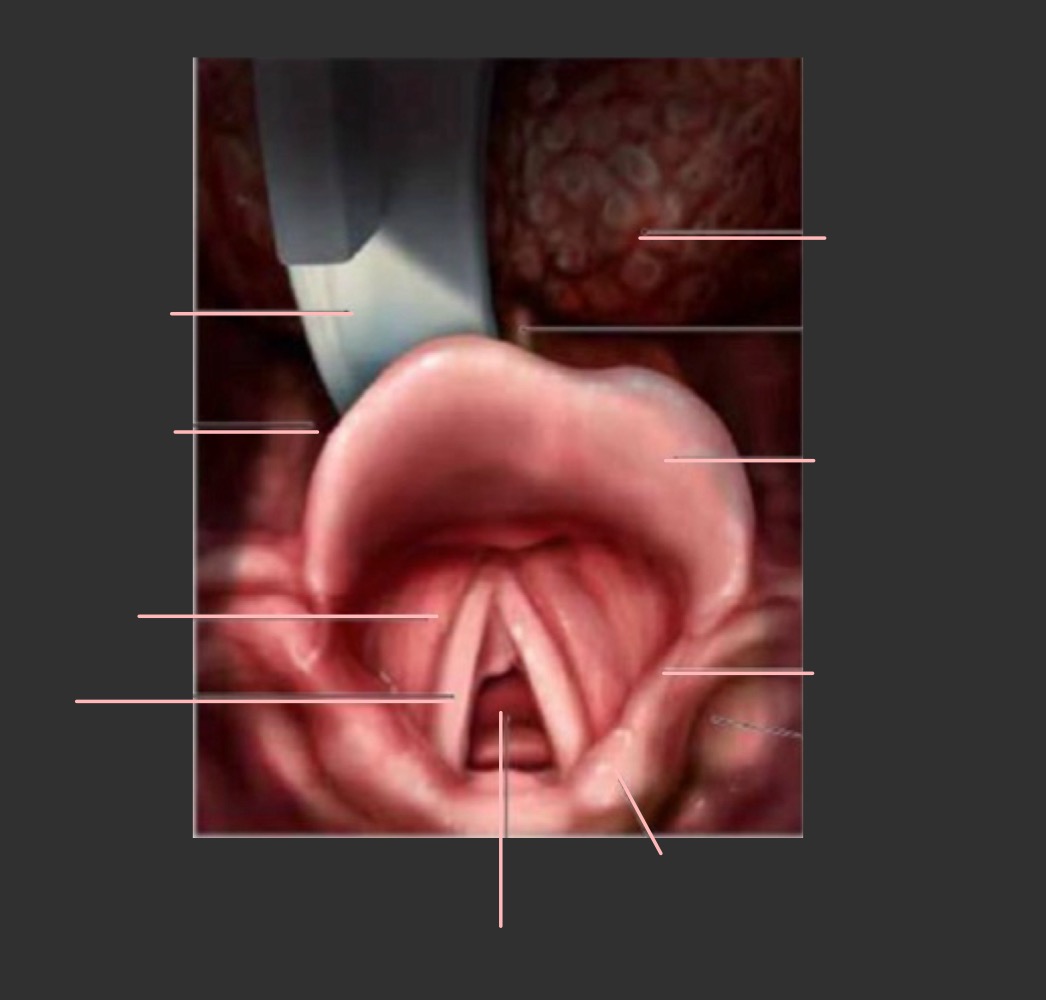 <p>Légender</p>