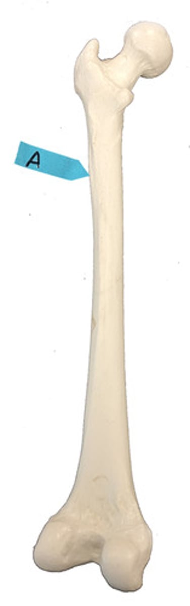<p>Identify this bone marking.</p>