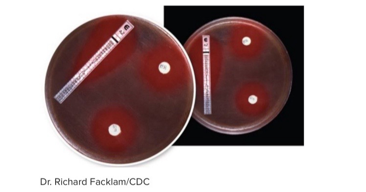 <p>The image shows a diffusion procedure known as the _____ -test, which can establish the minimum inhibitory concentration for a microbe </p>