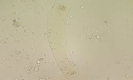 term image