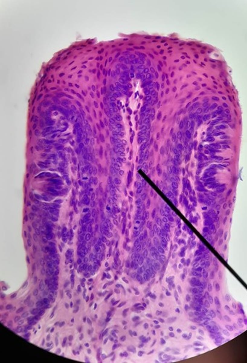 <p>Special: Taste</p><p>elevations found on the lateral aspect of the tongue of children</p>