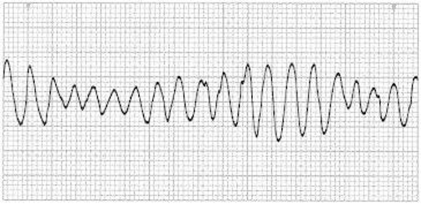 <p>Rhythm?</p><p>Management?</p>