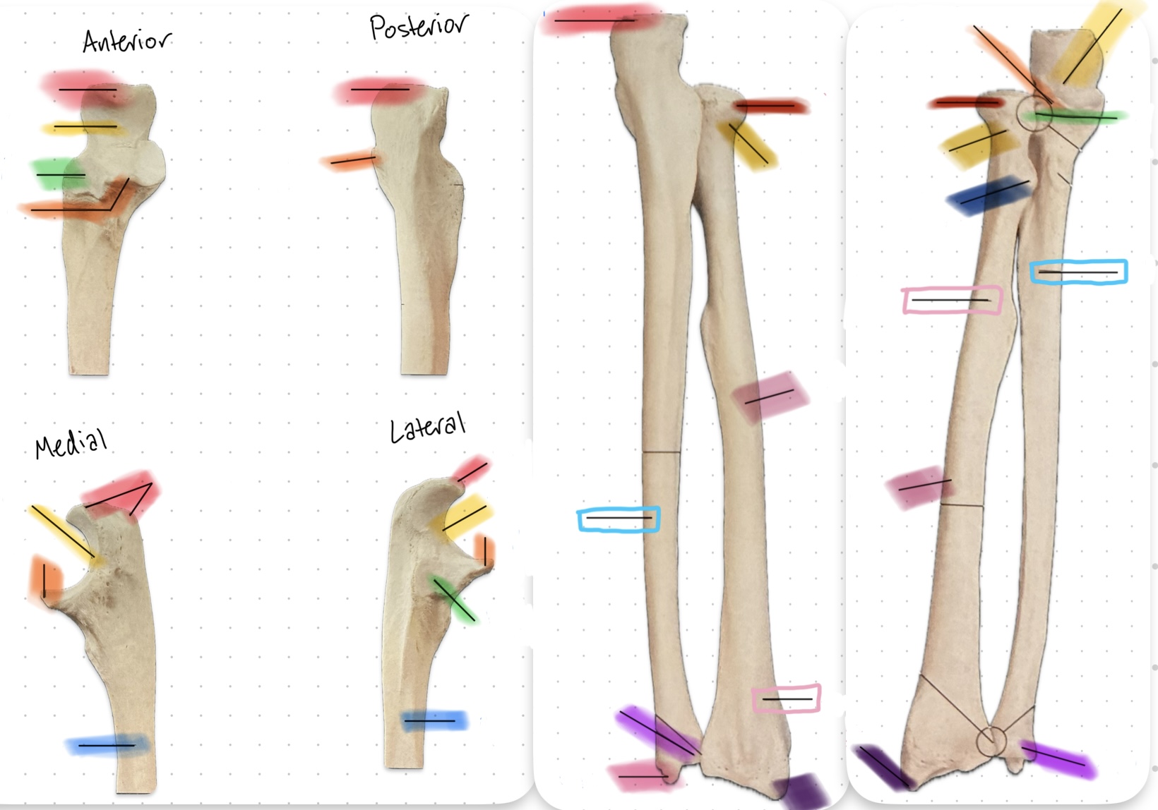 <p>What is the dark yellow part?</p>