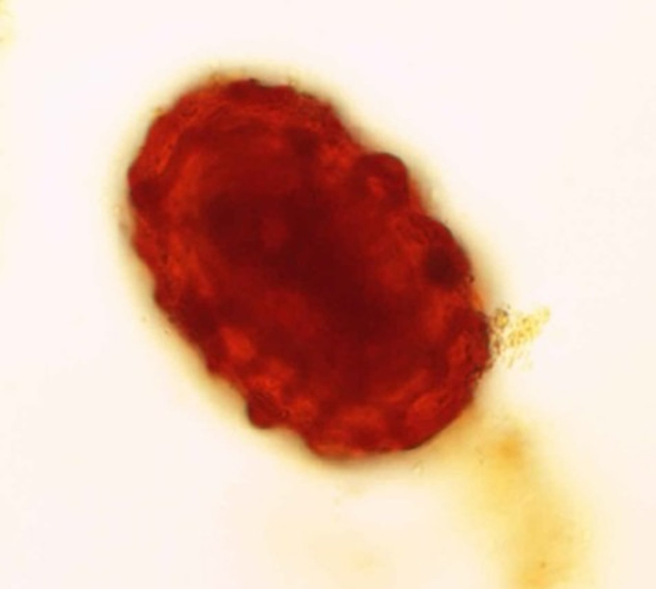 <p>Identify the parasite</p>