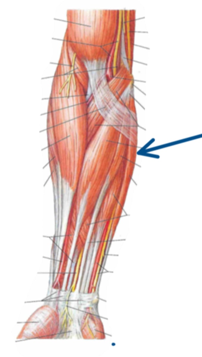 <p>Identify the innervation of the structure indicated by the arrow</p>