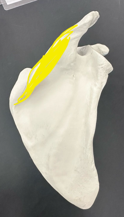 <p>What is highlighted in yellow?</p>