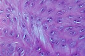 <p>Cartilage with dense collagen; resists compression and limits movement.</p>