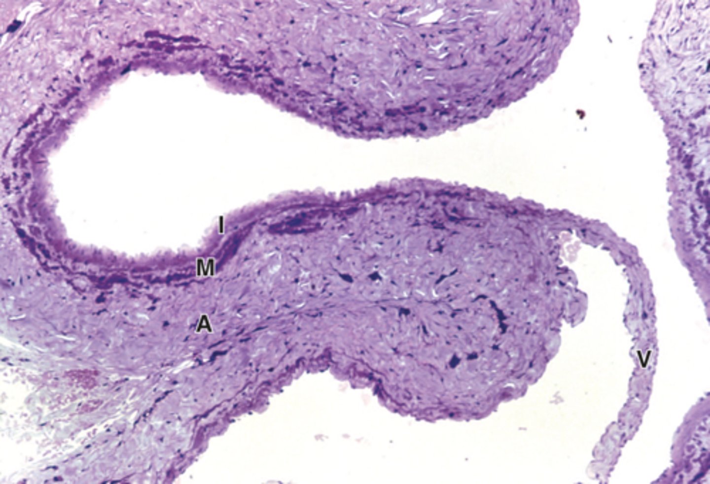 <p>ID tissue. What are each of the letters?large vein</p><p>I: tunica intima</p><p>M: tunica media</p><p>A: tunica adventitia</p><p>V: valve</p>
