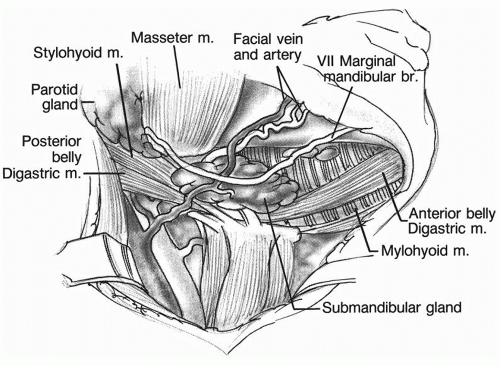 <p>In accessing the submandibular gland in the submandibular triangle, what vessel coursing through the gland and triangle would need to be protected?</p><p>A. External jugular vein</p><p><strong><mark data-color="red" style="background-color: red; color: inherit">B. Facial artery</mark></strong></p><p>C. Maxillary artery</p><p>D. Retromandibular vein</p><p>E. Superior thyroid artery</p>