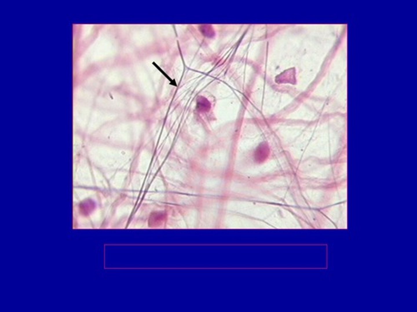 <p>Netlike interweaving of small fibrils that resist tensile (stretching) forces but have more "give"when elongated</p>
