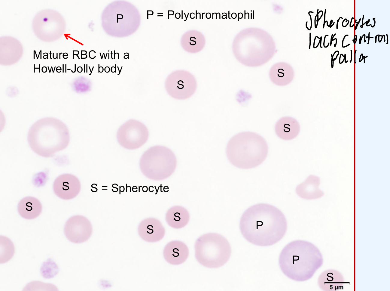 <ul><li><p><strong><u>IMHA (very common)</u></strong></p></li><li><p>Fragmentation hemolysis</p></li><li><p>Envenomation</p></li><li><p>Zinc toxicosis</p></li></ul><p></p><p>IMHA is at the top of your differential list when spherocytes are present</p>