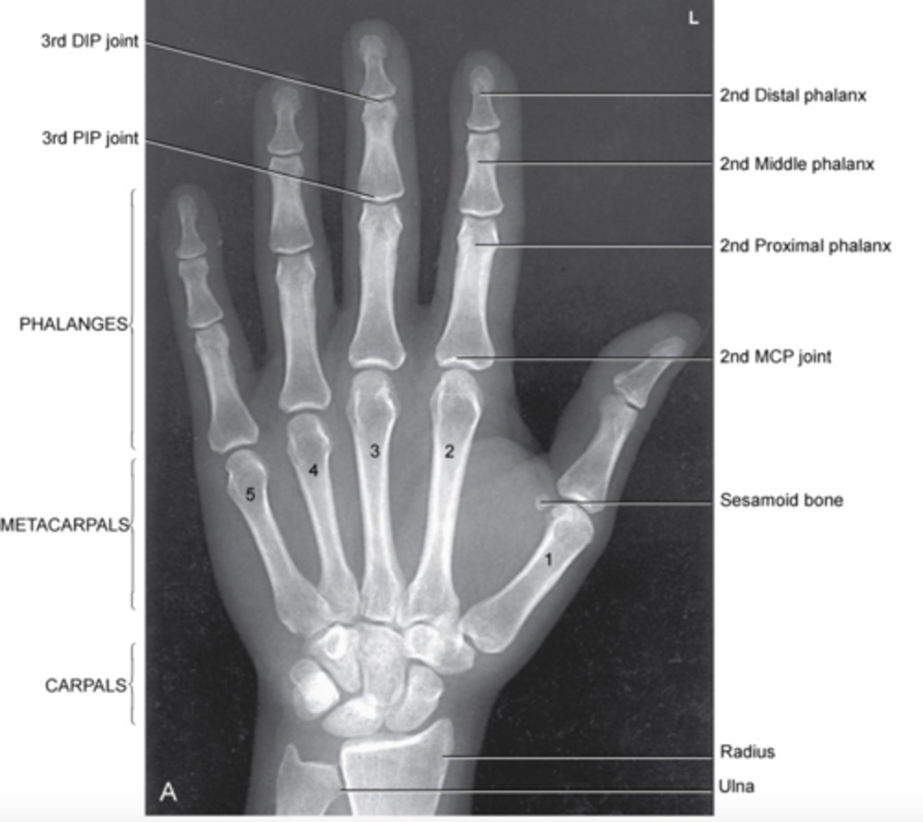 <p>-entire hand and wrist are visible</p><p>-MCP and IP joint should be open</p><p>-slightly separate digits</p><p>-equal concavity of metacarpal and phalangeal bodies</p>