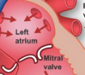 <p>blood from left atrium → left ventricle</p>