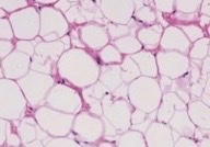 <p>What type of adipose tissue?</p>