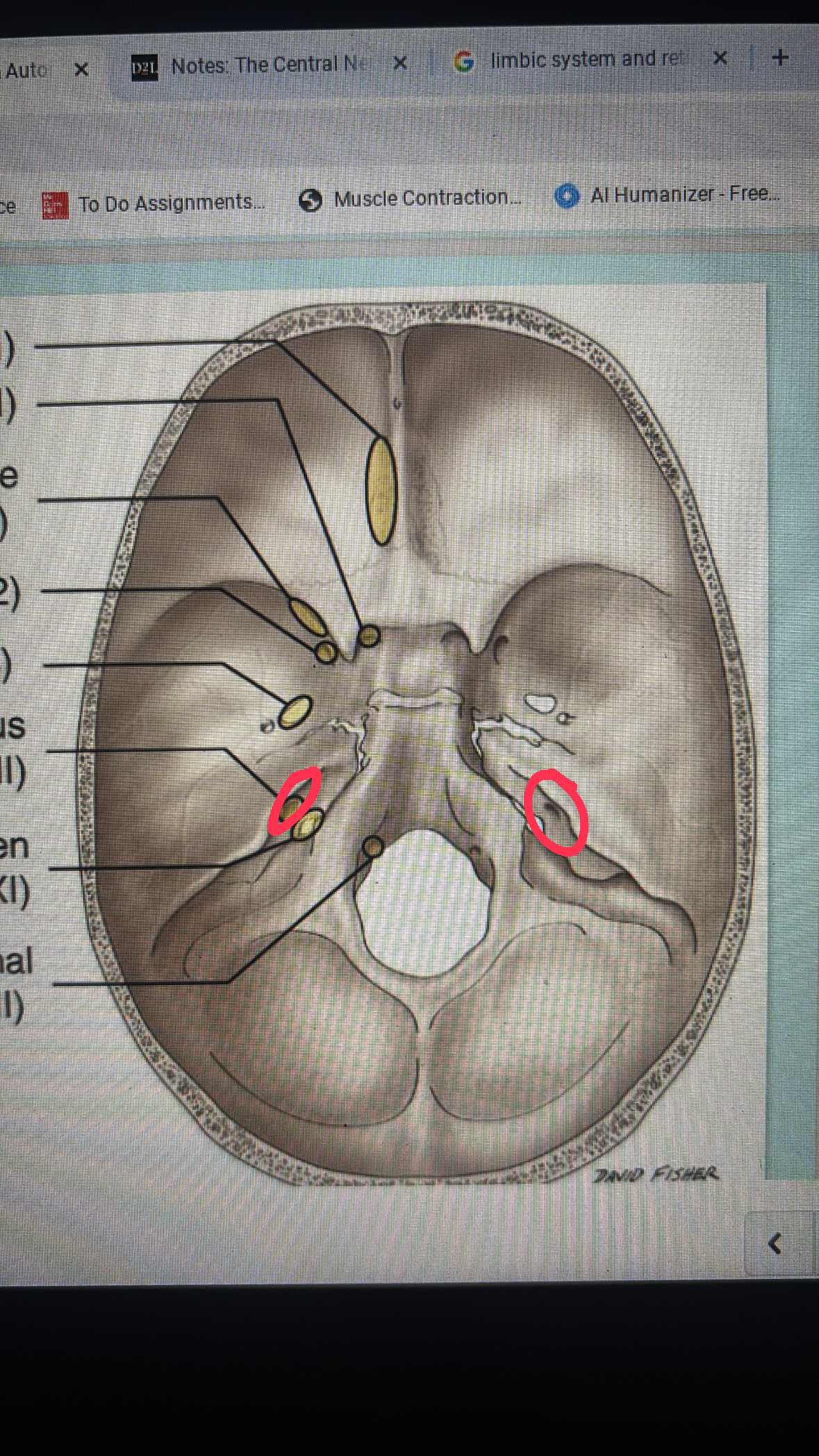 <p>cranial nerve VII AND VIII</p>