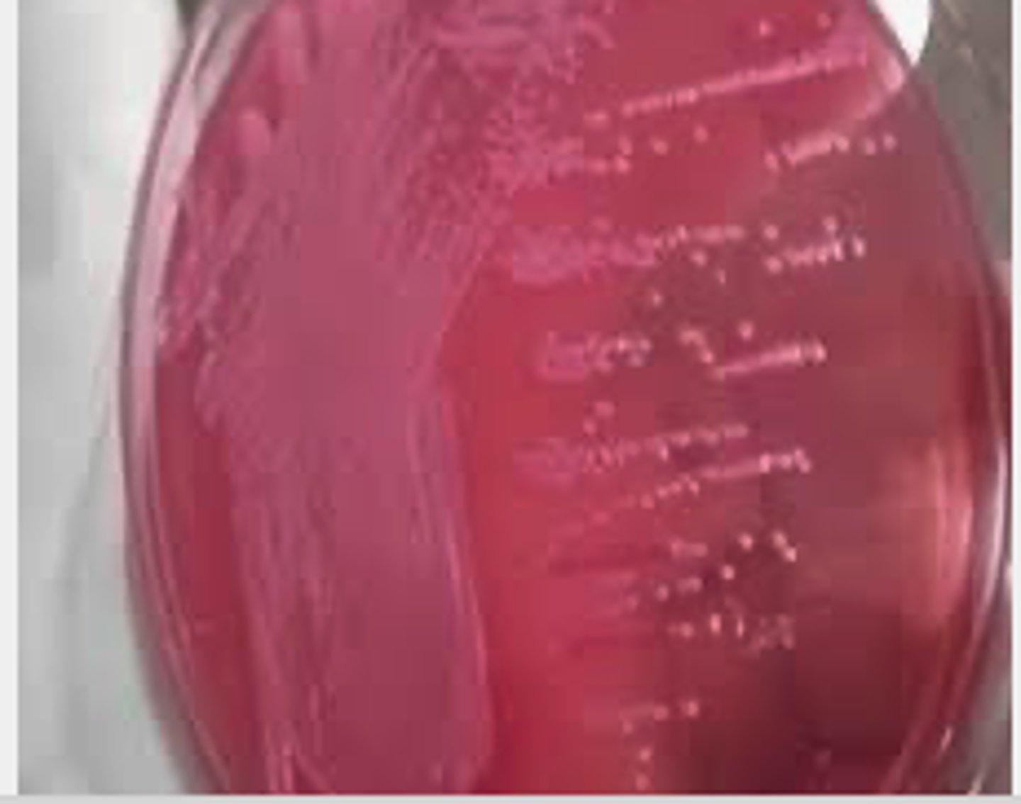 <p>A swab of feces from a neonatal calf (&lt; one week age) is provided. Examine your BA and MAC plates</p><p>Lactose positive or negative?</p>