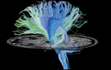 <p>What kind of scan is this</p>