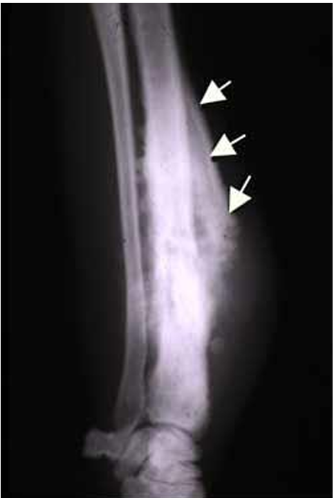 <p>which condition is this?</p>