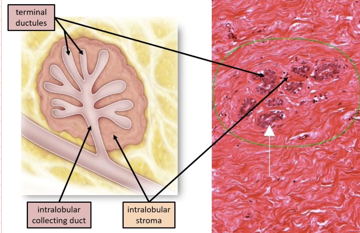 terminal duct lobular unit (TDLU)