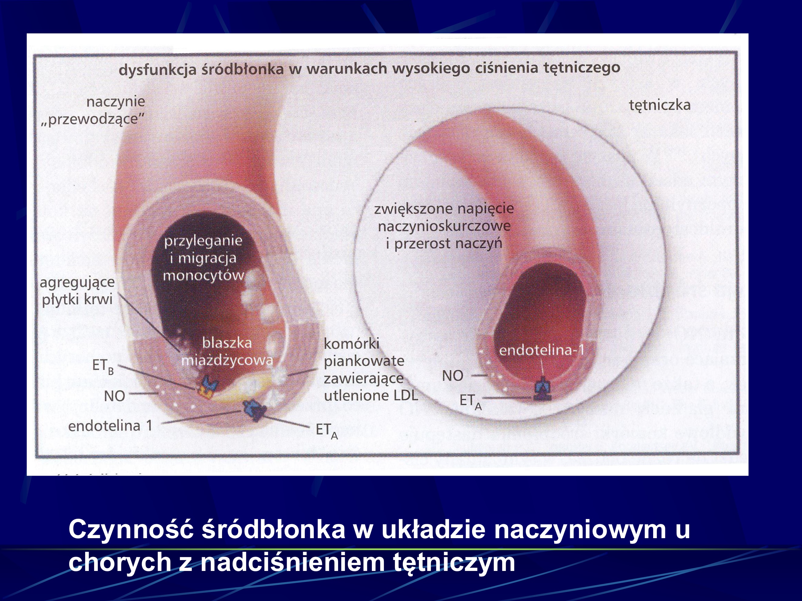<ul><li><p>upośledzenie syntezy śródbłonkowych substancji naczyniorozszerzających (NO, prostacyklina, bradykinia) przy prawidłowej lub nasilonej syntezie hormonów naczynioskurczowych (endotelina 1, angiotensyna II)</p></li><li><p>nadmierne wytwarzanie amin katecholowych i wzrost wrażliwości na katecholaminy</p></li><li><p>przebudowa i usztywnienie ściany naczyniowej ze zwężenie jego światła</p><ul><li><p>stymulowane przez lokalne układy renina-angiotensyna, endotelina 1, insulinę (hiperinsulinizm wtórny w stosunku do insulinooporości)</p></li><li><p>hamowany przez NO, naczyniowe czynniki natriutetyczne i bradyknine</p></li></ul></li></ul><p></p>