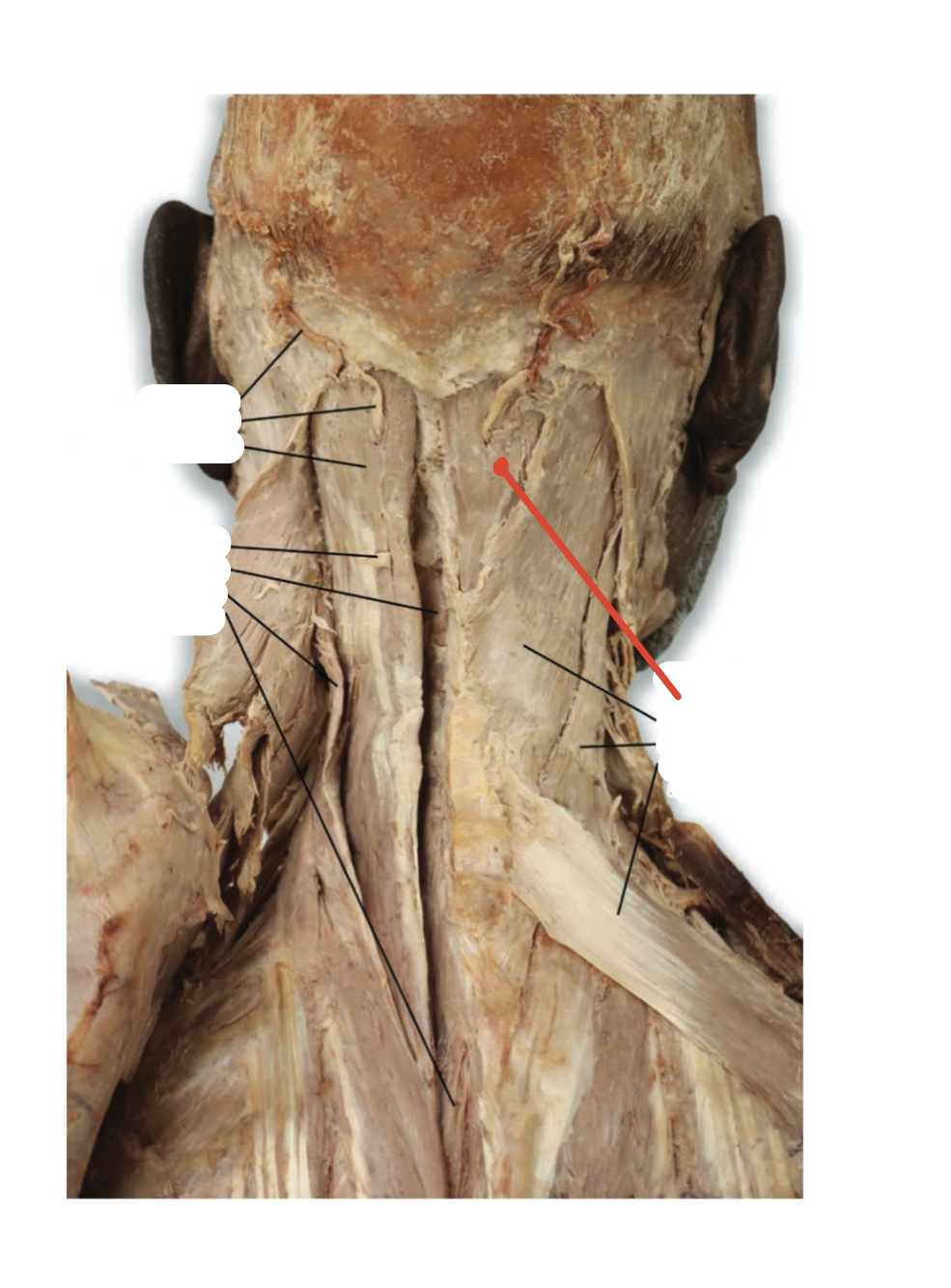 Identify the structure (red line)