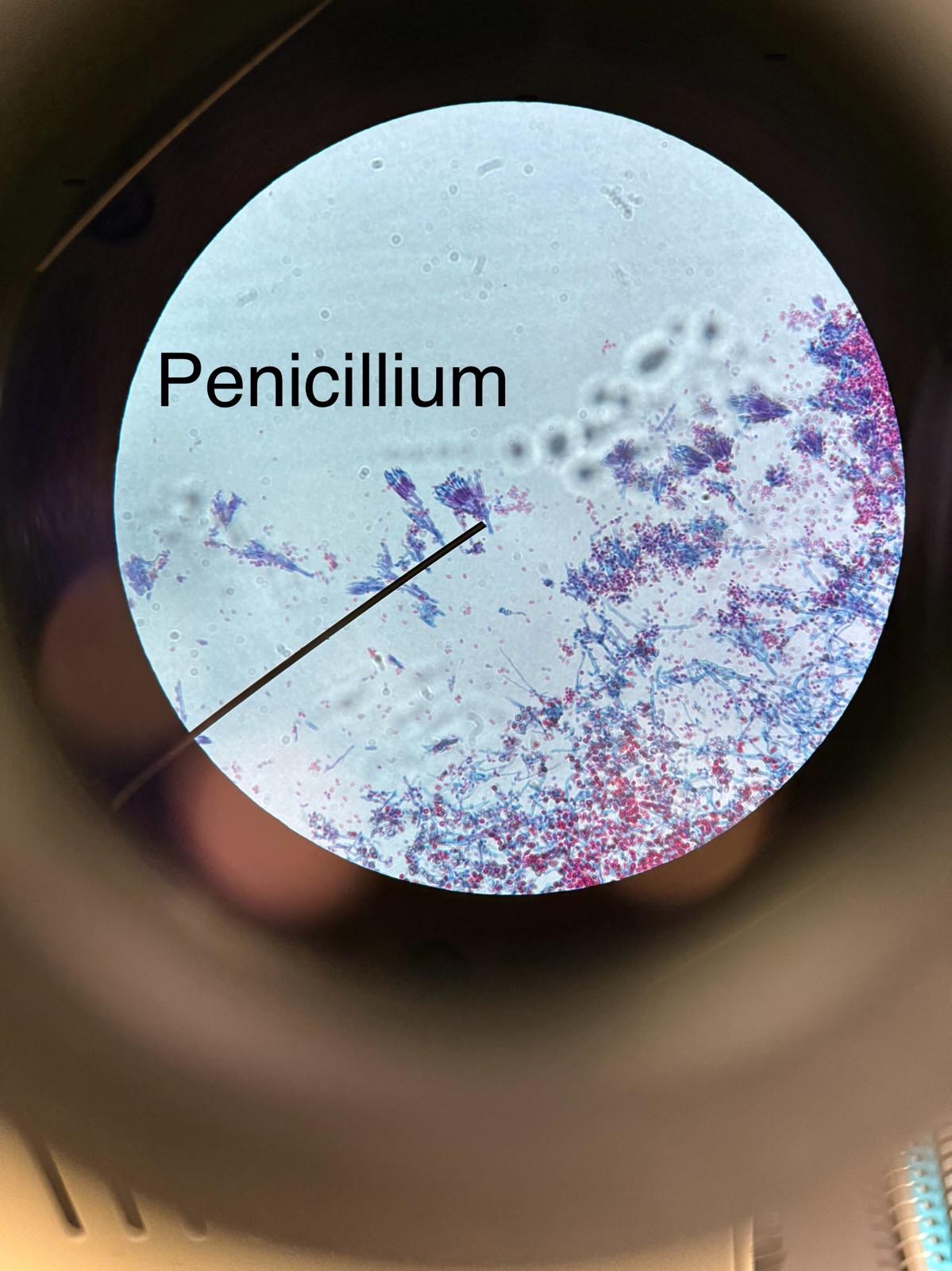 <p>penicillium</p>