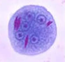 <p>Identify the organism based on the cyst form</p>