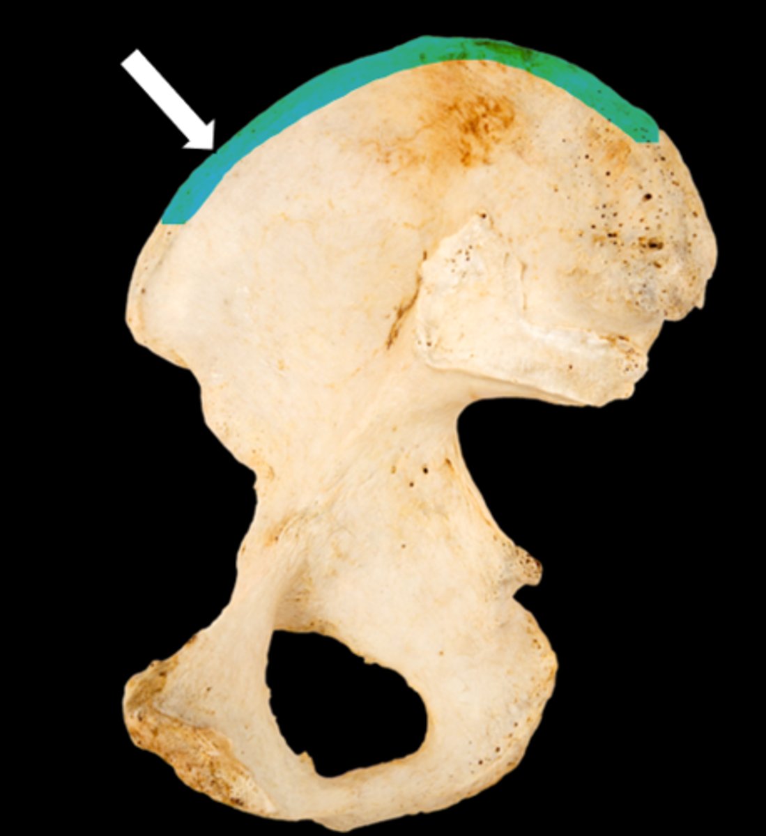 <p>name the part</p>