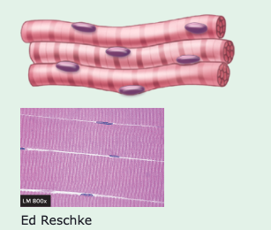 <p>striated appearance</p>