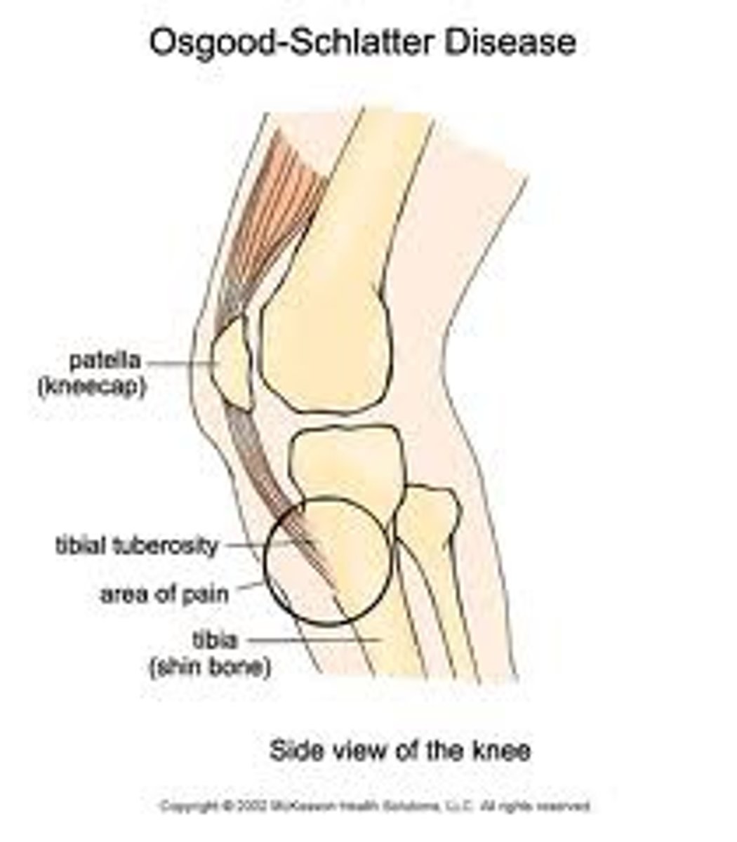 <p>adolescent male athletes</p>