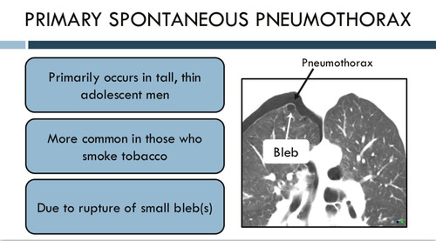 <p>1) primarily occurs in tall, thin adolescent men</p><p>2) more common in those who smoke tobacco</p><p>3) caused due to the rupture of small bleb(s): no presence of lung disease</p>