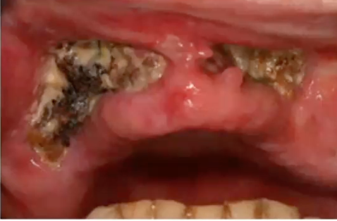 <p>what is the diagnosis based ONLY on the image</p>