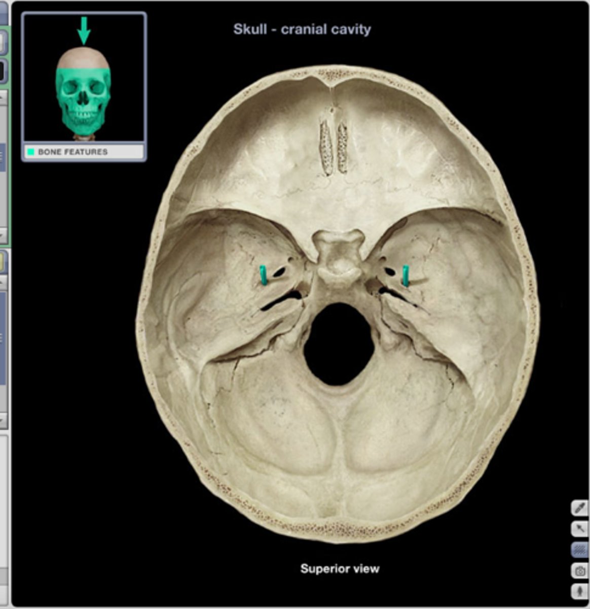 <p>internal</p><p>pin hole of the cranial base most posterior whole of the middle of the cranial base</p>