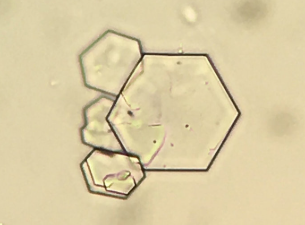 <p>What do you see in this image? What can it indicate?</p>