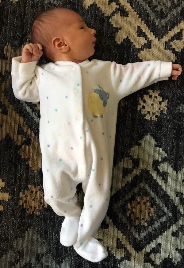 <p>disappears at 7 months </p>