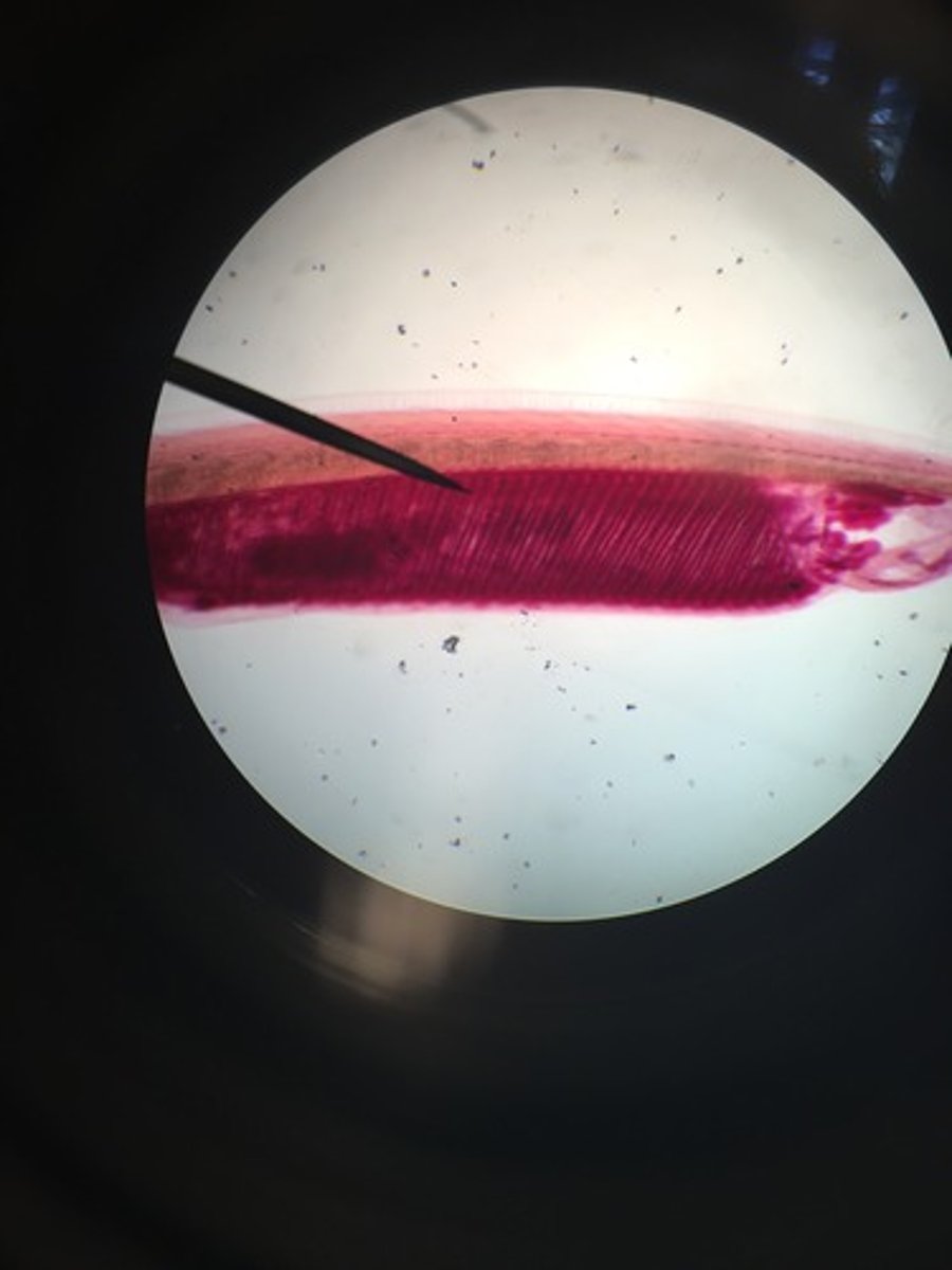 <p>What is it?</p><p>Subkingdom?</p><p>Phylum?</p><p>Subphylum?</p>