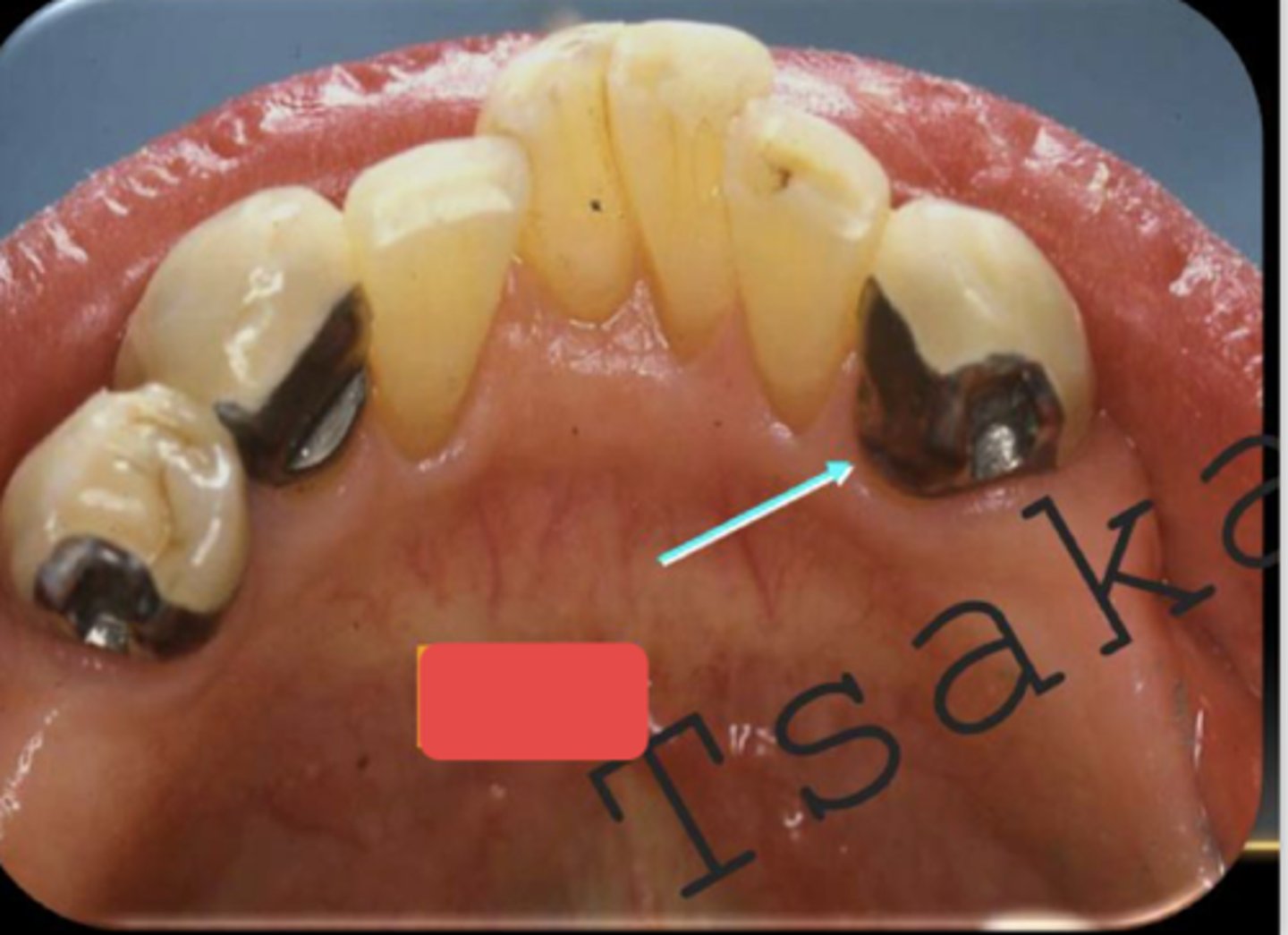 <p>What is the arrow pointing to?</p>