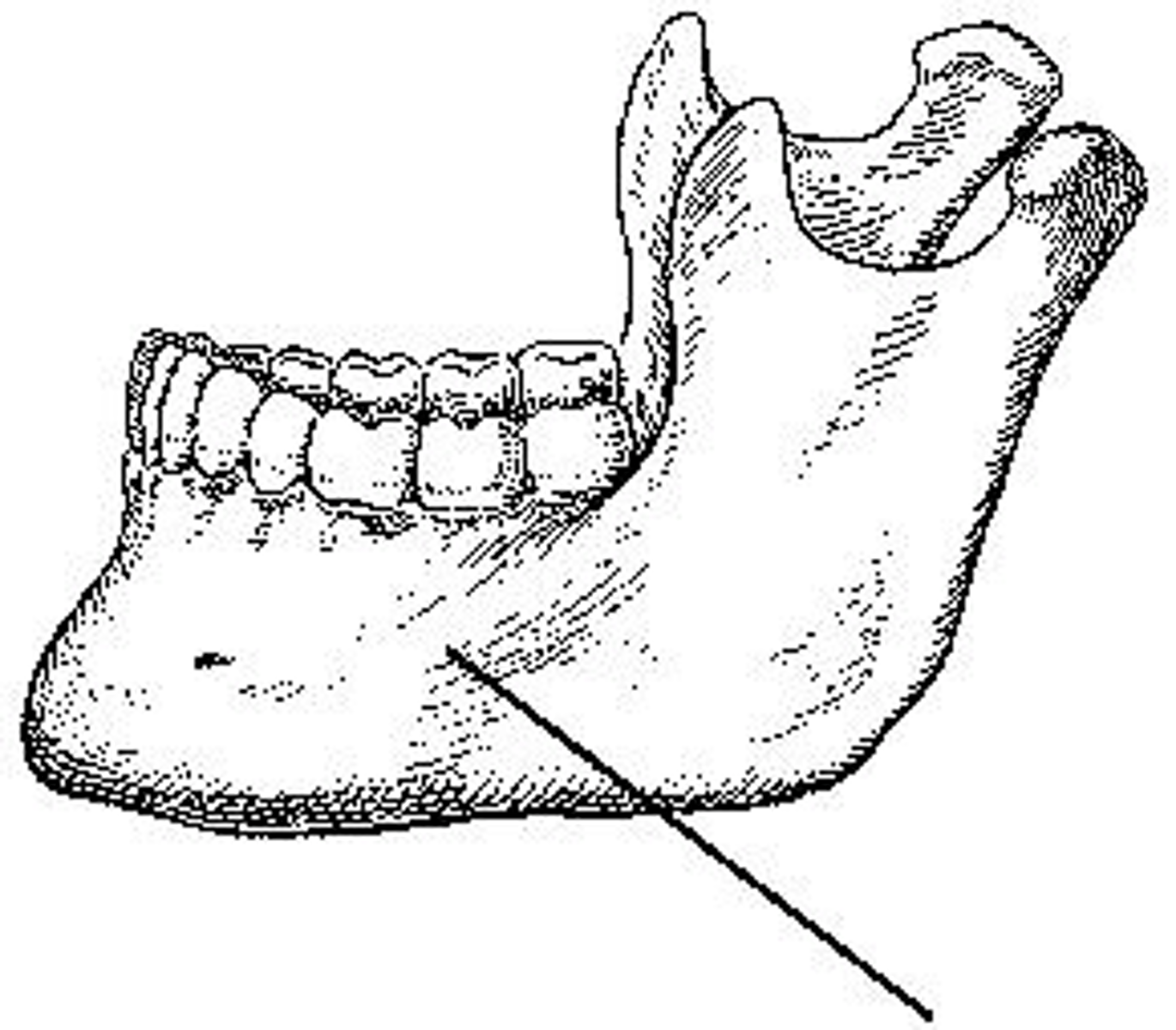 <p>What part of the mandible is identified?</p>