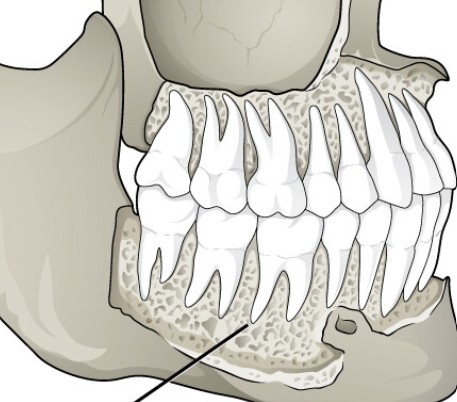 <p>Which type of synarthrotic joint has:</p><ul><li><p>Fibrous connection (periodontal ligament)</p></li><li><p>Binds teeth to sockets</p></li></ul><p></p>
