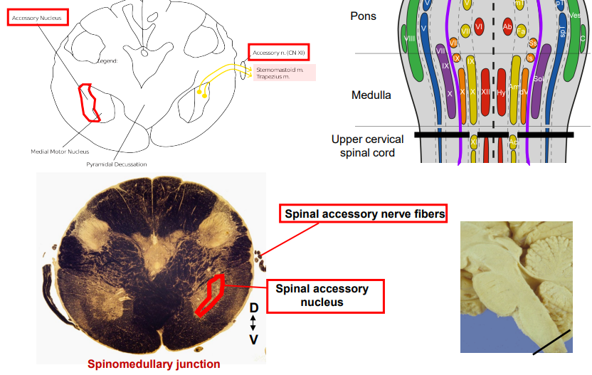 <ul><li><p>Nerve Location: Upper Cervical Segments C1 - C4/5</p></li><li><p>Nuclei Location:</p><ul><li><p>Nucleus Ambiguus: Caudal medulla within the reticular formation (hard to see)</p></li><li><p>Spinal Accessory Nucleus: Upper cervical cord and spinomedullar junction, located where normally the ventral horn would be</p><ul><li><p>Synapse with UMNs from Corticobulbar Tract (bilateral)</p></li></ul></li></ul></li></ul><p></p>