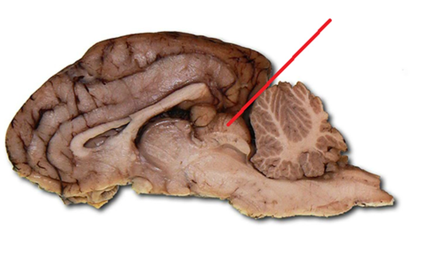 <p>name the whole structure</p>