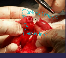 <p><span>Considerations for Small Intestinal Surgery</span></p>