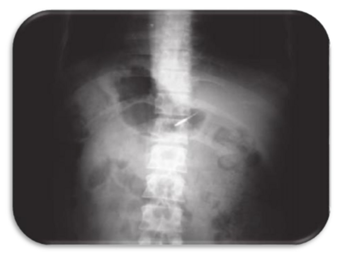 <p>What does this photo emphasize the importance of?</p>