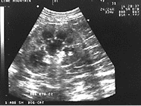 <p>Edge Shadowing</p>