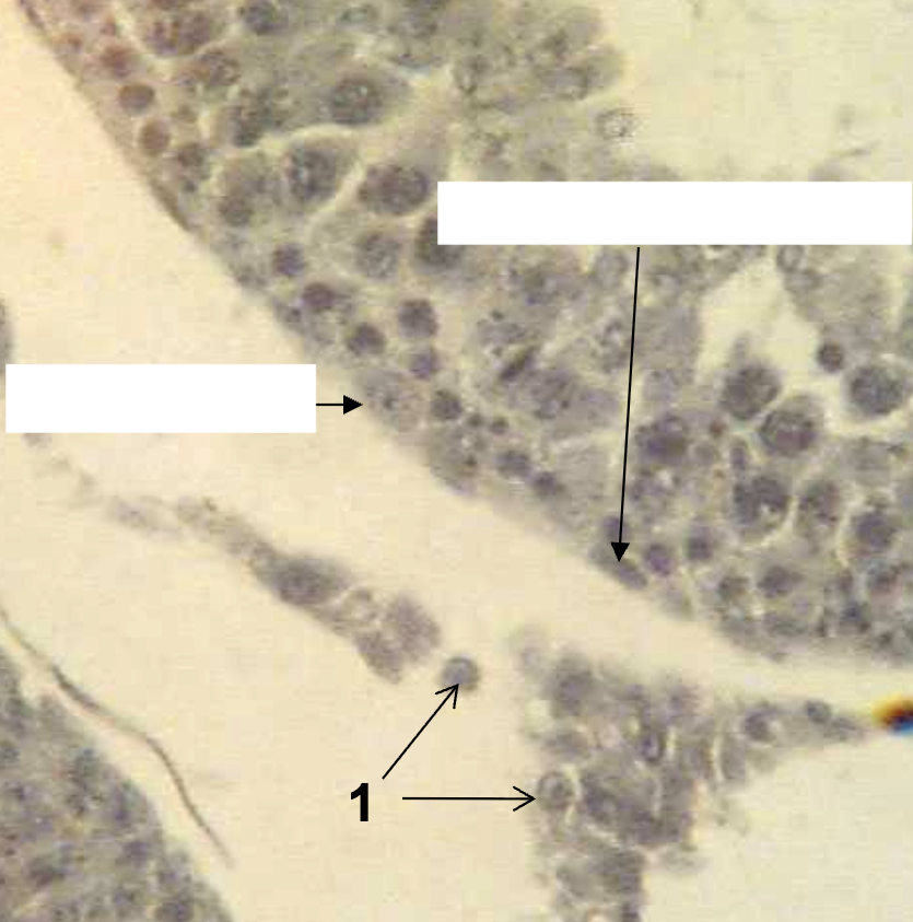 <p>What structures are being indicated by #1?</p>
