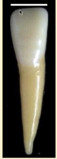 <p><mark data-color="red" style="background-color: red; color: inherit">mandibular central incisors #24 and #25; facial view</mark></p>