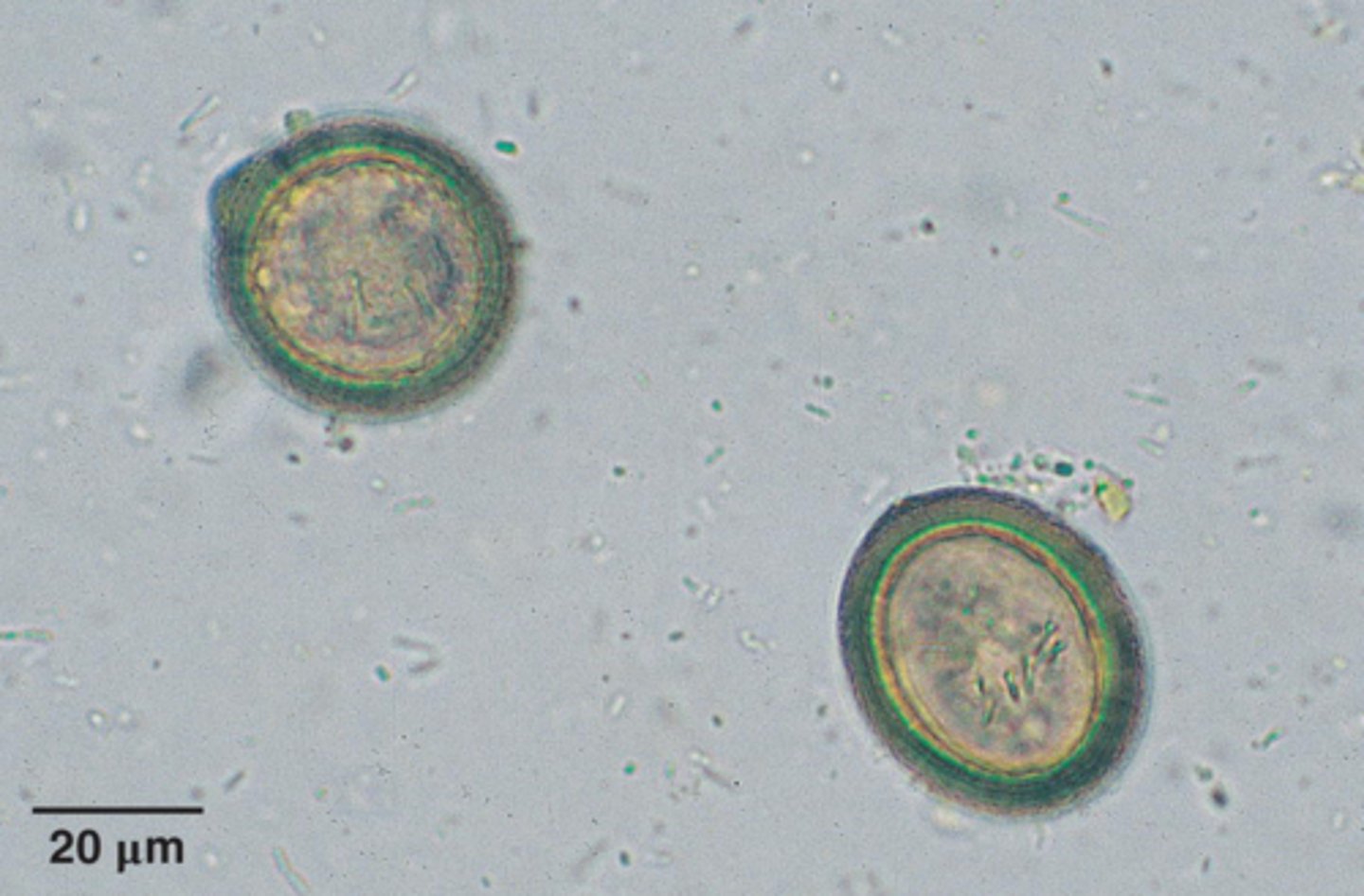 <p>What parasite is this if it is from a dog</p>