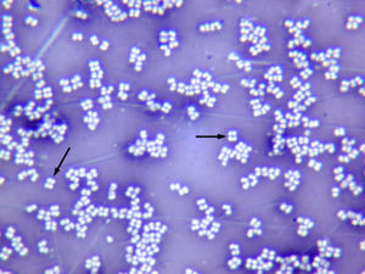 <p>Clusters of four cocci</p>
