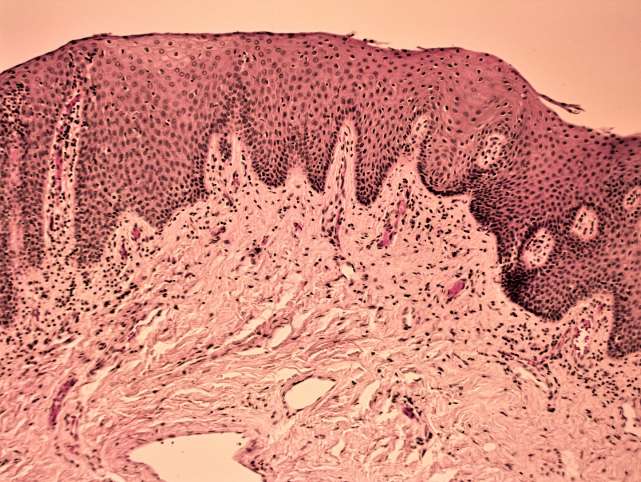<p>A type of epithelial tissue composed of multiple layers of cells, with the outermost layer remaining moist. It is found lining body cavities and organs such as the mouth, esophagus, and vagina. </p>